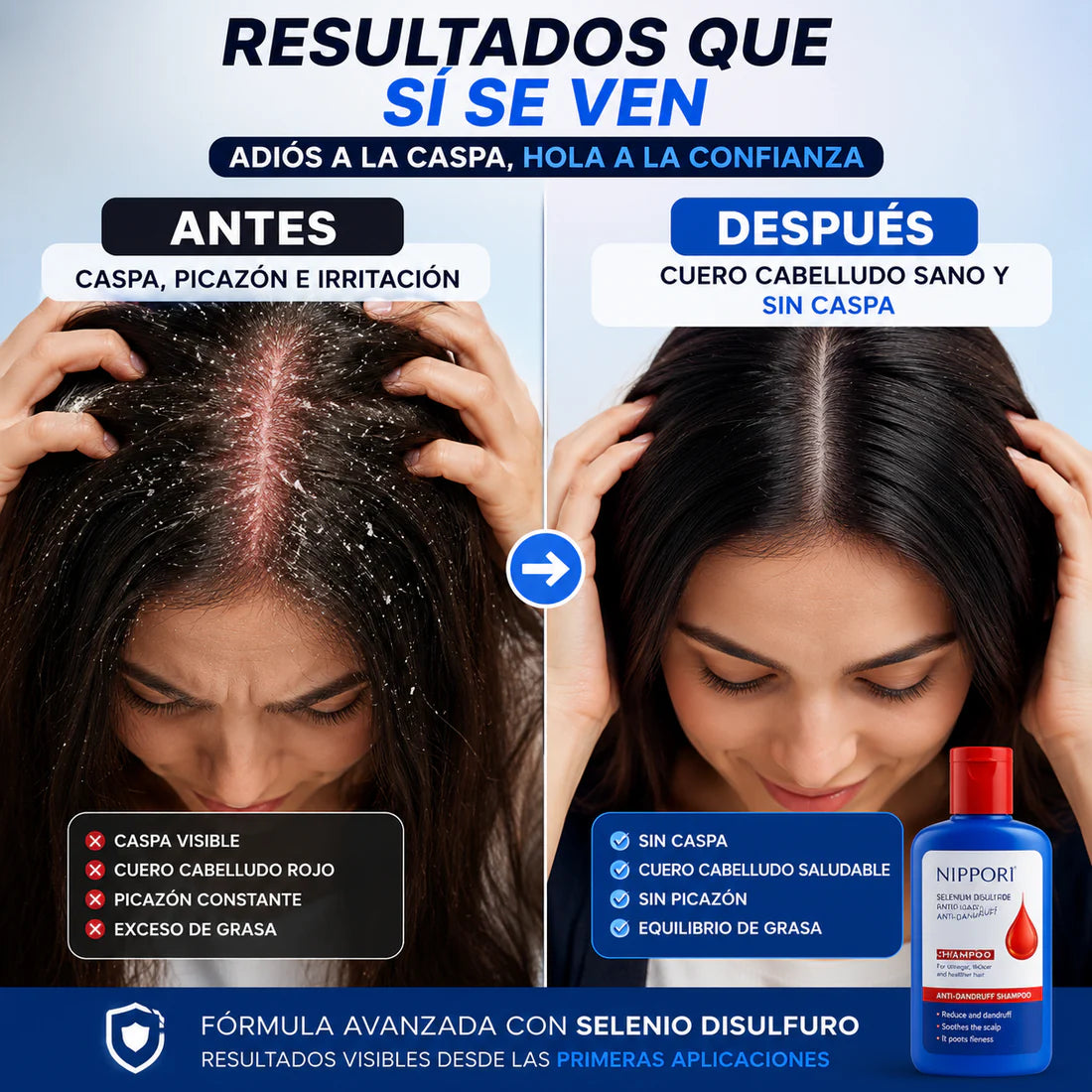 Nippori® Shampoo Anticaspa (300ml)