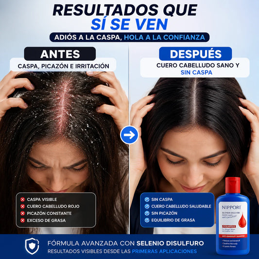Nippori® Shampoo Anticaspa (300ml)