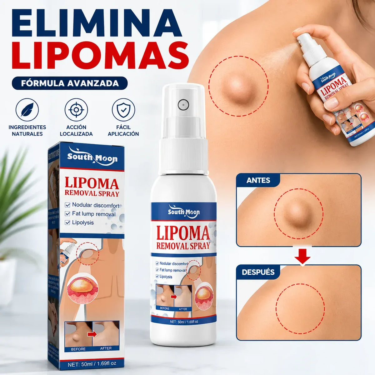 LipoOut™ Spray Reductor de Lipomas y Bultos de Grasa (30ml)